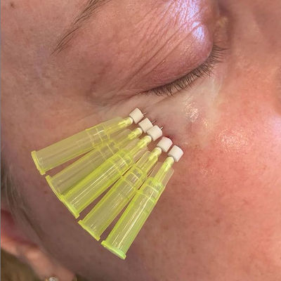 type absorbable de l'ascenseur W de fil de 25mm Pdo Pcl canule émoussée pour la perte de dessous de volume d'oeil