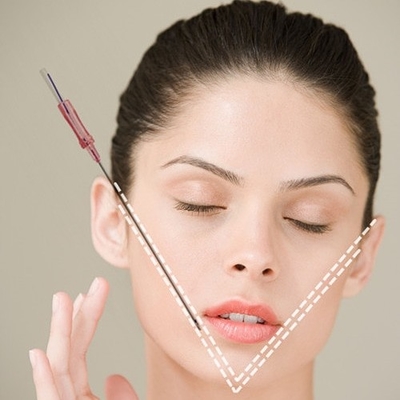 Fil Nonsurgical de dent de levage de visage de fil de PDO 18G 100mm pour le levage de visage instantané